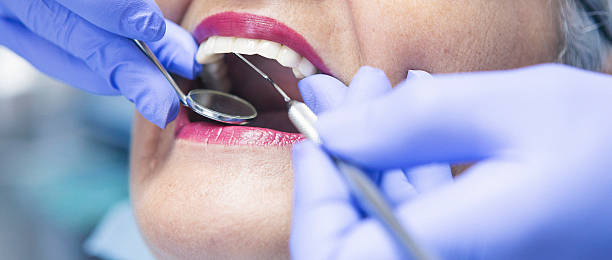 Best Knocked-Out Tooth (Avulsed Tooth) Treatment in Salem Heights, OH